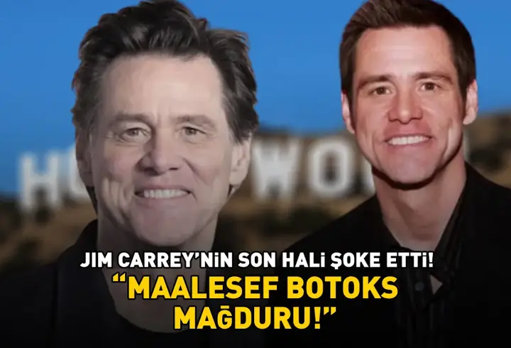 Jim Carrey'nin son hali şoke etti! 'Maalesef botoks kurbanı!'