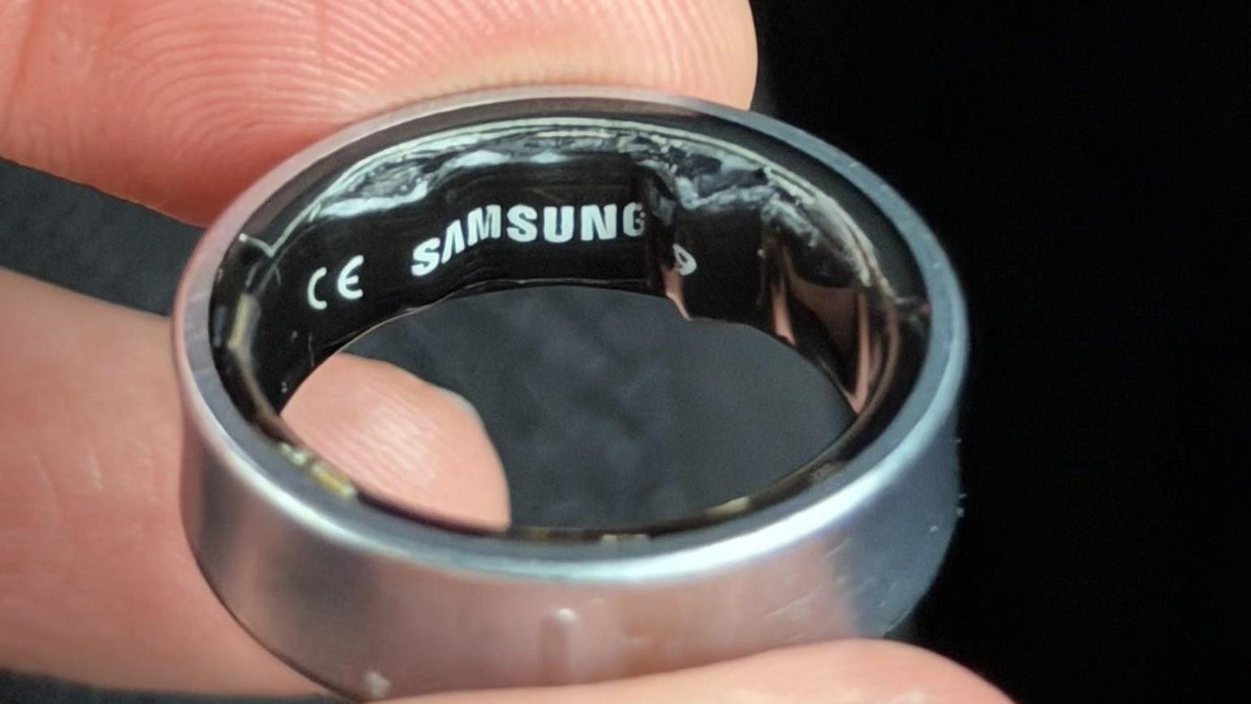 Galaxy Ring’in bataryası şişti, kullanıcı hastanelik oldu